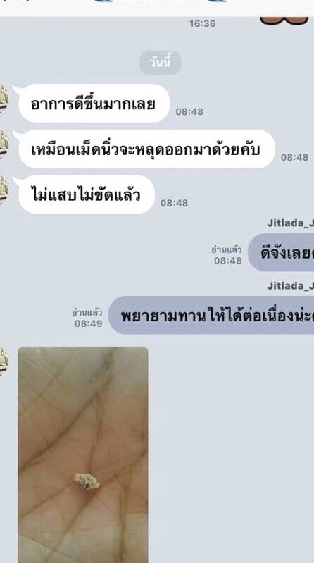 ปัสสาวะบ่อย นิ่ว